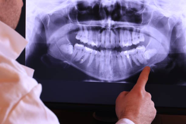 Best Emergency Dental Care for Broken or Chipped Teeth in Arcadia, WI